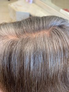 2. The natural regrowth showing the percentage of dark hair and white or grey hair 225x300 - Grey Blending Hairdresser in Tweed Heads | Transitioning to Natural Grey Hair