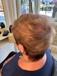 Main Photo After 1 225x300 - Caring for Grey Blending Transition